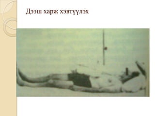 Дээш харж хэвтүүлэх
 