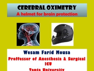 Cerebral Oximetry
A helmet for brain protection
Wesam Farid Mousa
Proffessor of Anesthesia & Surgical
ICU
 