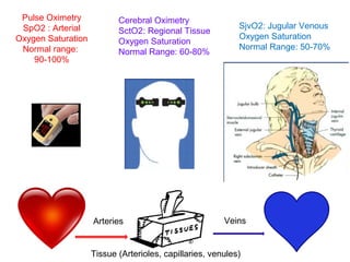 Cerebral oximetry brain protection in cardiac surgery | PPT