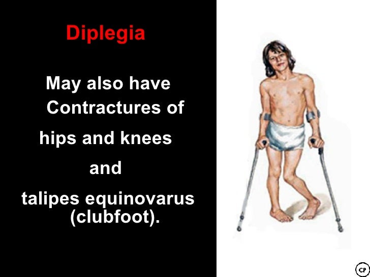 Cerebral Palsy