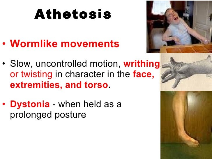 cerebral palsy athetoid cerebral palsy