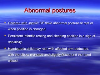 Spastic Posture Cerebral palsy الشلل الدماغي | PPT