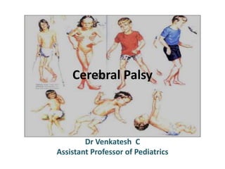 Cerebral Palsy 
Dr Venkatesh C 
Assistant Professor of Pediatrics 
 