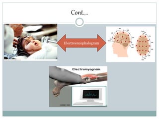 Cont….
Electroencephalogram
 