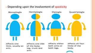  Depending upon the involvement of spasticity
 