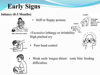 Cerebral Palsy (CP) is a group of neurological disorders caused by brain damage or abnormal development during pregnancy, birth, or early infancy. Early recognition of CP is crucial, as timely intervention can significantly improve motor function and overall quality of life.
