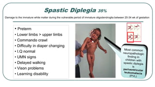 • Preterm
• Lower limbs > upper limbs
• Commando crawl
• Difficulty in diaper changing
• I.Q normal
• UMN signs
• Delayed walking
• Vison problems
• Learning disability
Spastic Diplegia 35%
Damage to the immature white matter during the vulnerable period of immature oligodendroglia between 20-34 wk of gestation
IAPUGTeachingslides2015-16
OGRAPHICAL OR ANATOMICAL
/Tetraplegia
plegia
12
 