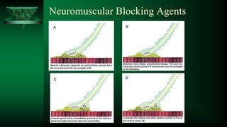 CP Neuromuscular Blocking Agents
 