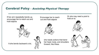 If her arm repeatedly bends up,
encourage her to reach out and
hold objects
Or she may need a post to
hold on to.
Encourage her to reach
out and hold objects
It she bends backward a lot,
she needs actions that bend
her head, body, and shoulders
forward, like these.
Cerebral Palsy - Assisting Physical Therapy
 