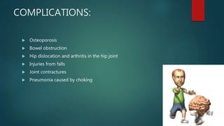 COMPLICATIONS:
 Osteoporosis
 Bowel obstruction
 Hip dislocation and arthritis in the hip joint
 Injuries from falls
 Joint contractures
 Pneumonia caused by choking
 