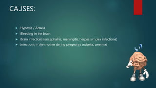 CAUSES:
 Hypoxia / Anoxia
 Bleeding in the brain
 Brain infections (encephalitis, meningitis, herpes simplex infections)
 Infections in the mother during pregnancy (rubella, toxemia)
 
