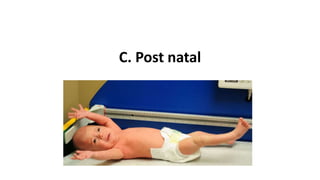 C. Post natal
 