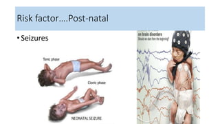 • Seizures
Risk factor….Post-natal
 