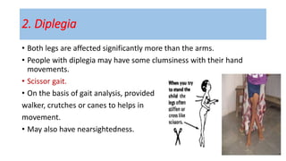 2. Diplegia
• Both legs are affected significantly more than the arms.
• People with diplegia may have some clumsiness with their hand
movements.
• Scissor gait.
• On the basis of gait analysis, provided
walker, crutches or canes to helps in
movement.
• May also have nearsightedness.
 