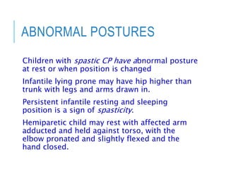 Spastic Posture Cerebral palsy | PPT
