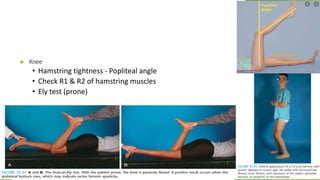 Hamstring Length R1 And R2 Cerebral palsy.pptx