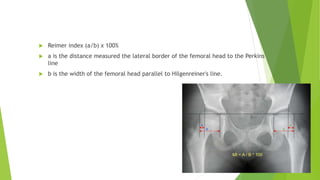 Cerebral palsy.pptx