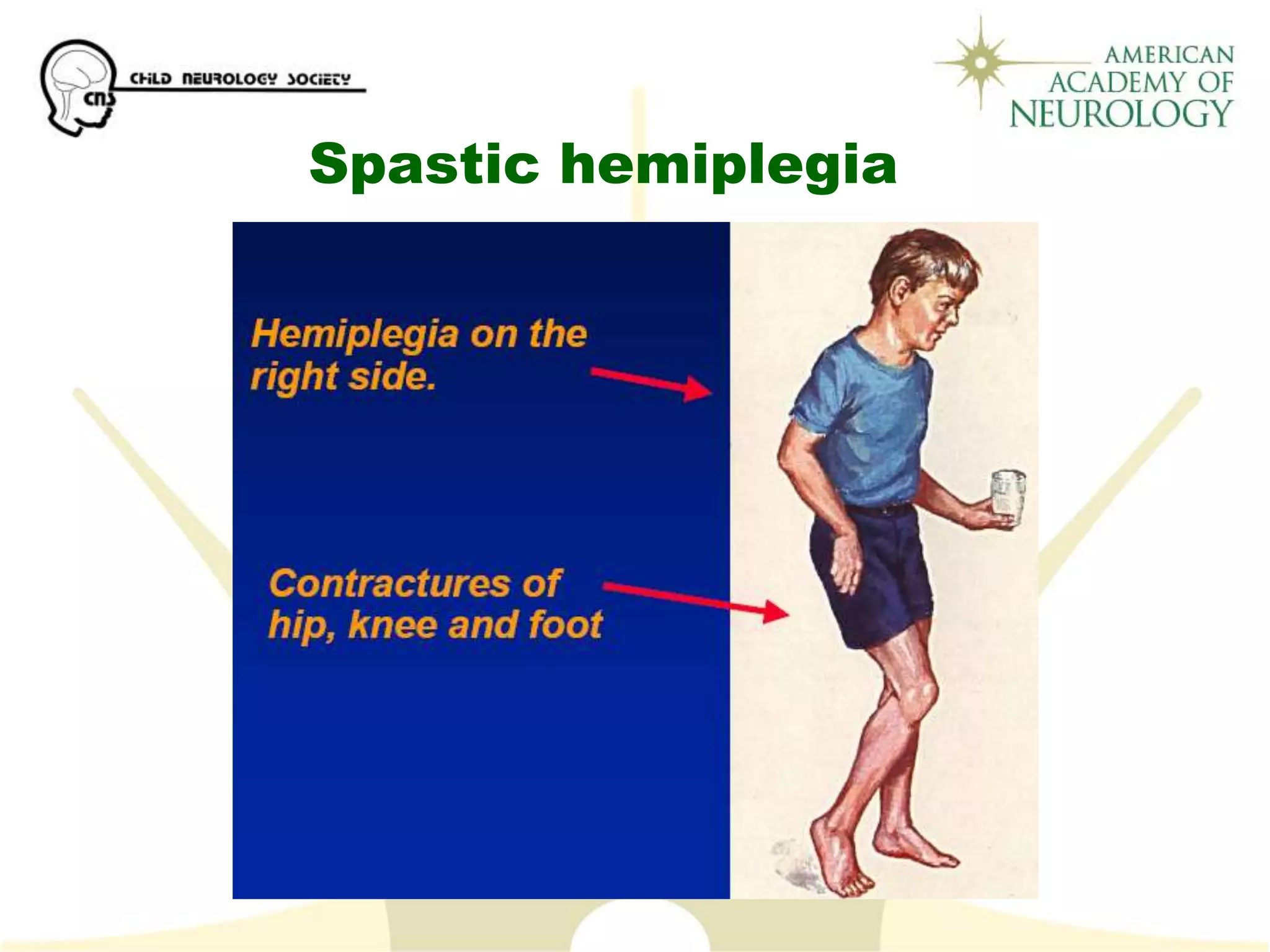Spastic Posture Cerebral_Palsy.ppt