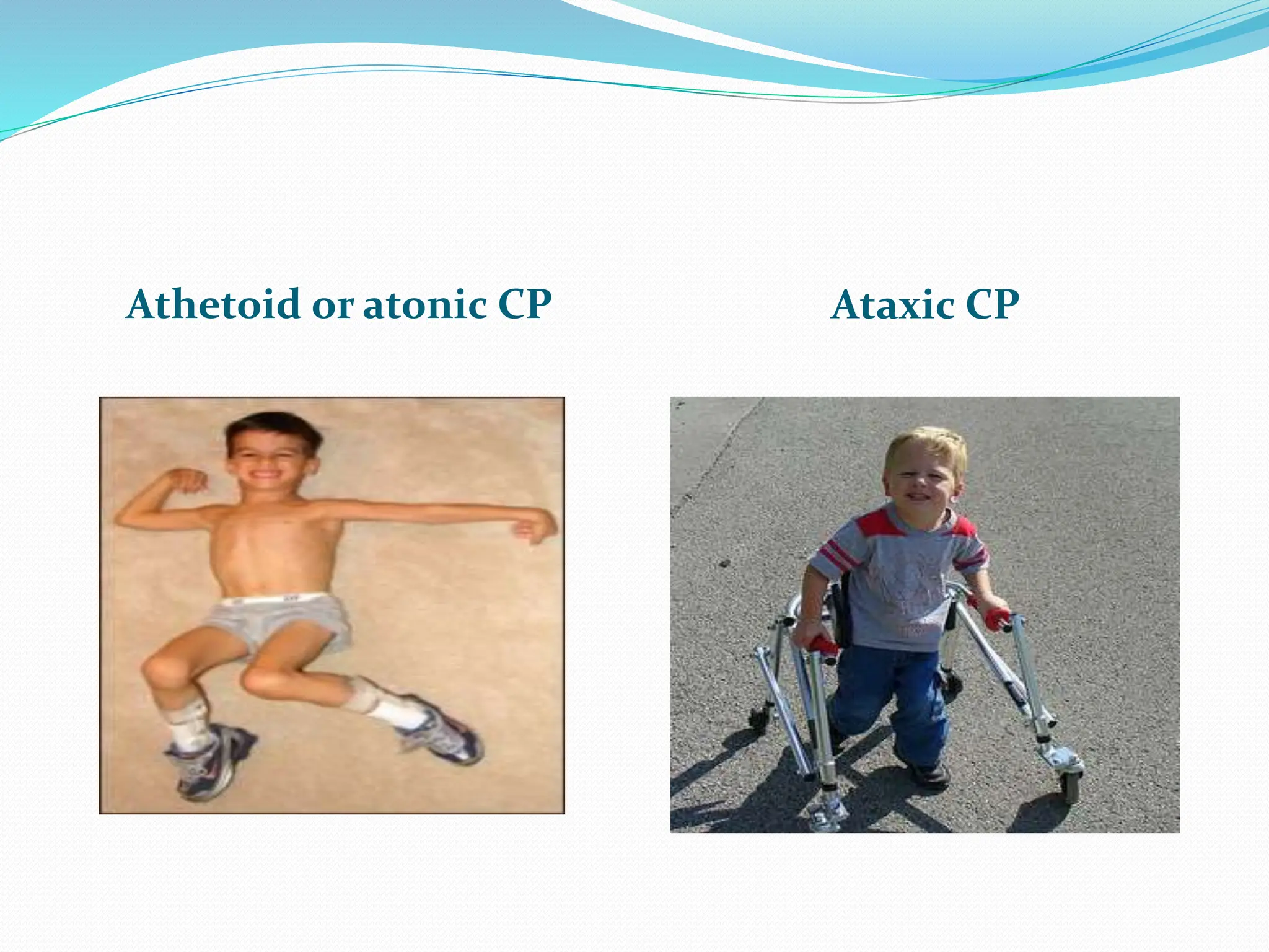 cerebral palsy.pptx for nursing students.ppt