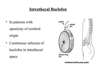 Intrathecal Baclofen
• In patients with
spasticity of cerebral
origin
• Continuous infusion of
baclofen in intrathecal
space
 
