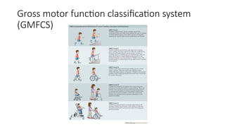 cerebral palsy in children and management.pptx