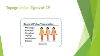 Topographical Types of CP
 