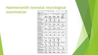 Hammersmith neonatal neurological
examination
 