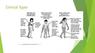 Clinical Types
This Photo by Unknown Author is licensed under CC BY-SA
 