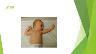 ATNR
 