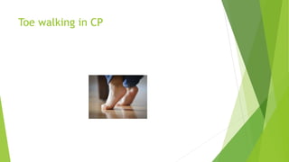 Toe walking in CP
 