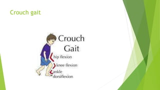 Crouch gait
 