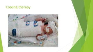 Cooling therapy
 