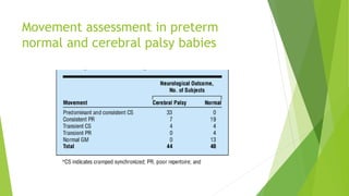 Movement assessment in preterm
normal and cerebral palsy babies
 