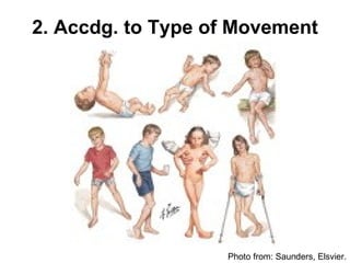 2. Accdg. to Type of Movement




                   Photo from: Saunders, Elsvier.
 