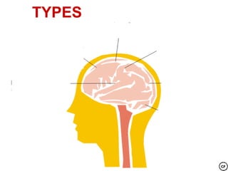TYPES
                SPASTIC -Stiffness



ATHETOID
--Fluctuating
 Uncontrolled
   Tone
Movements

                               ATAXIC
                               -Unsteady,
                                Unsteady,
                             uncoordinated
                             uncoordinated
 