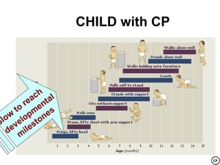 CHILD with CP




          ch al
        ea nt
       r e
    t o m es
  ow elop ton
Sl v
   e i l es
  d m
 