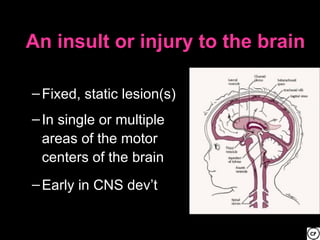 An insult or injury to the brain

– Fixed, static lesion(s)
– In single or multiple
  areas of the motor
  centers of the brain
– Early in CNS dev’t
 