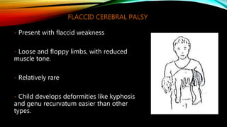 2.TOPOGRAPHICAL CLASSIFICATION
- Classification of cerebral palsy based on the parts of body
affected. It includes 6 types:
 