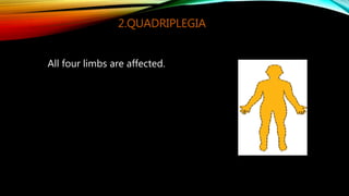 3.TRIPLEGIA
Involvement of three limbs.
Usually both the arms and one leg are
affected.
 