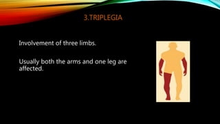 4.HEMIPLEGIA
One side of the body is affected .The arm
is usually more involved than the leg.
Circumduction of the leg.
 