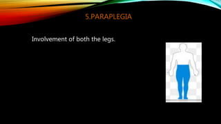 6.DIPLEGIA
Involvement of four limbs with the legs
more affected than the arms.
Spastic diplegia gaits (true equinus, jump...
