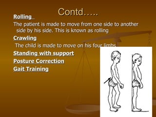 Rolling
                  Contd…..
The patient is made to move from one side to another
 side by his side. This is known a...