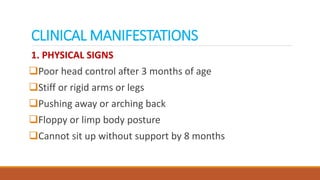 CLINICAL MANIFESTATIONS
1. PHYSICAL SIGNS
Poor head control after 3 months of age
Stiff or rigid arms or legs
Pushing away or arching back
Floppy or limp body posture
Cannot sit up without support by 8 months
 