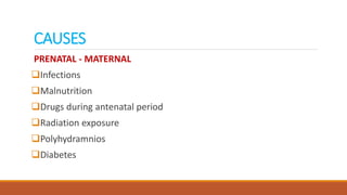 CAUSES
PRENATAL - MATERNAL
Infections
Malnutrition
Drugs during antenatal period
Radiation exposure
Polyhydramnios
Diabetes
 