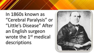 In 1860s known as
“Cerebral Paralysis” or
“Little’s Disease” After
an English surgeon
wrote the 1st medical
descriptions.
 