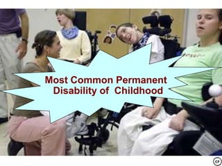 Most Common Permanent
Disability of Childhood

 