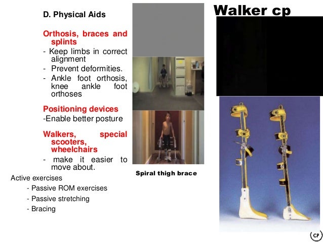 acupuncture adults with cerebral palsy acupuncture adults with cerebral palsy