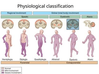 Cerebral Palsy MBBS students UGS 4th yearpptx | PPTX