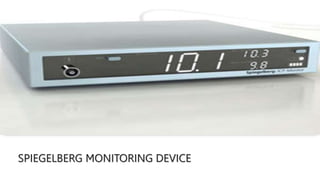 SPIEGELBERG MONITORING DEVICE
 