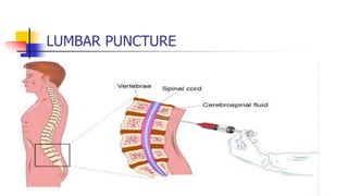 LUMBAR PUNCTURE
 